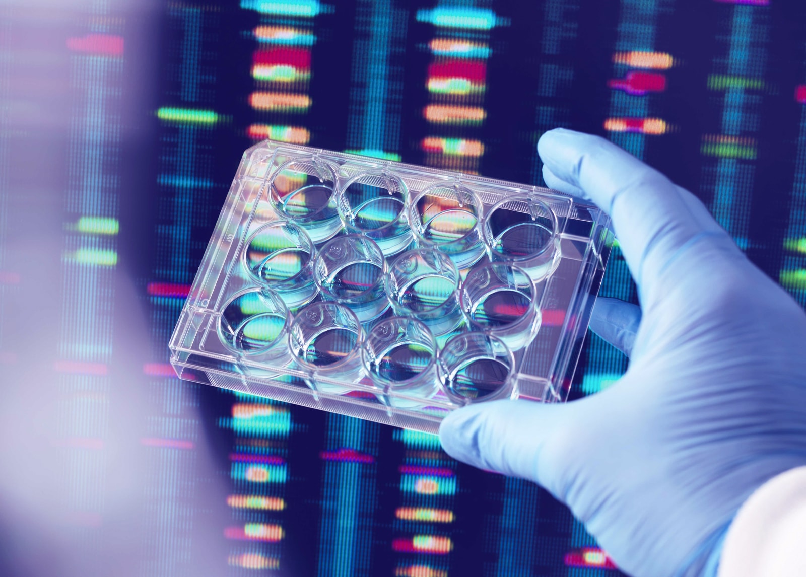 Whole genome sequencing could save NHS millions of pounds, study suggests